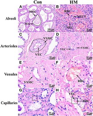 DIA proteomics identified the potential targets associated with angiogenesis in the mammary glands of dairy cows with hemorrhagic mastitis